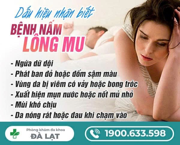 Hình ảnh minh họa